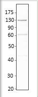 Anti-Adenylate cyclase 6 antibody used in Western blot. GTX47802
