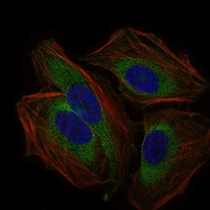 Anti-CD59 antibody [8D2B8] used in ICC/IF. GTX60658