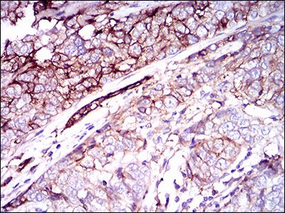 Anti-CD59 antibody [8D2B8] used in IHC (Formalin-fixed paraffin-embedded sections). GTX60658