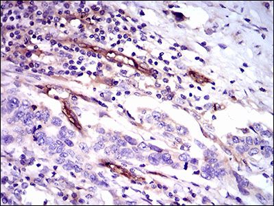 Anti-CD59 antibody [8D2B8] used in IHC (Formalin-fixed paraffin-embedded sections). GTX60658