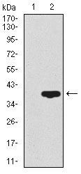 Anti-CD59 antibody [8D2B8] used in Western blot. GTX60658