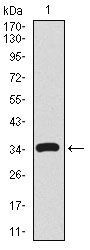 Anti-CD59 antibody [8D2B8] used in Western blot. GTX60658