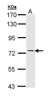 Anti-adenylate kinase 7 antibody [C1C3] used in Western blot. GTX111770