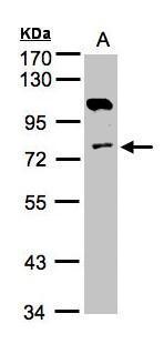 Anti-Adenylate kinase 7 antibody [N2C3] used in Western blot. GTX103600