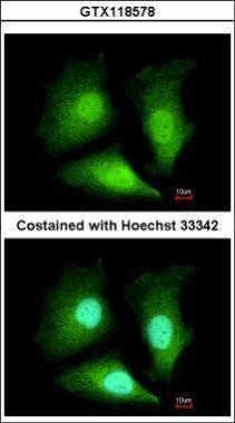 Anti-ADI1 antibody used in ICC/IF. GTX118578