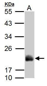 Anti-ADI1 antibody used in Western blot. GTX118578