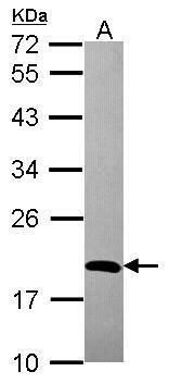 Anti-ADI1 antibody used in Western blot. GTX118578