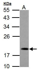 Anti-ADI1 antibody used in Western blot. GTX118578