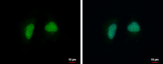 Anti-ADPRHL1 antibody used in ICC/IF. GTX120706