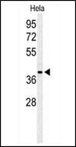 Anti-ADPRHL2 antibody used in Western blot. GTX53536