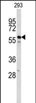 Anti-CDC14B antibody, Internal used in Western blot. GTX80573