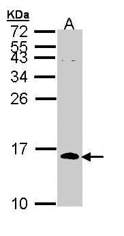 Anti-CDC26 antibody [N1C3] used in Western blot. GTX111007