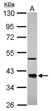 Anti-CDC37L1 antibody [N1C2] used in Western blot. GTX118885