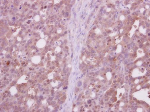 Anti-CDC37L1 antibody [N3C3] used in IHC (Formalin-fixed paraffin-embedded sections). GTX119311