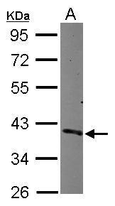 Anti-CDC37L1 antibody [N3C3] used in Western blot. GTX119311