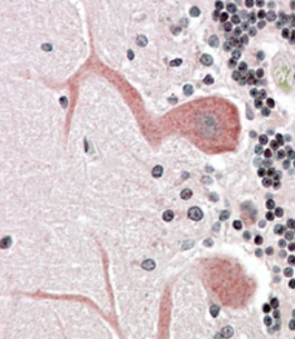 Anti-Cdc42-binding kinase alpha antibody, N-term used in IHC (Formalin-fixed paraffin-embedded sections). GTX89739