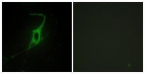 Anti-CDH20 antibody used in ICC/IF. GTX87050