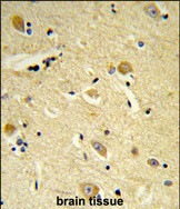 Anti-CDIPT antibody, Internal used in IHC (Formalin-fixed paraffin-embedded sections). GTX80599