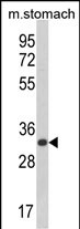 Anti-CDIPT antibody, Internal used in Western blot. GTX80599
