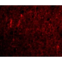 Anti-CDNF antibody used in ICC/IF. GTX85431