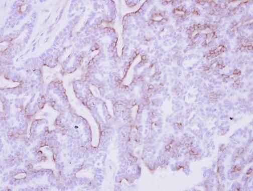 Anti-CDO antibody [N1N2], N-term used in IHC (Formalin-fixed paraffin-embedded sections). GTX105422