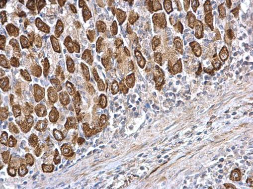 Anti-CDS1 antibody [C1C3] used in IHC (Formalin-fixed paraffin-embedded sections). GTX112491