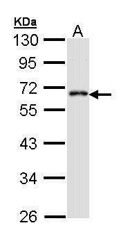 Anti-CDS1 antibody [C1C3] used in Western blot. GTX112491