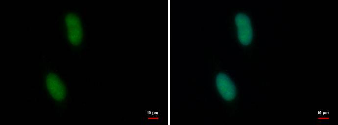 Anti-CDYL2 antibody used in ICC/IF. GTX128239