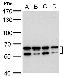 Anti-CDYL2 antibody used in Western blot. GTX128239