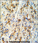 Anti-CECR5 antibody, Internal used in IHC (Formalin-fixed paraffin-embedded sections). GTX81173