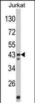 Anti-CECR5 antibody, Internal used in Western blot. GTX81173