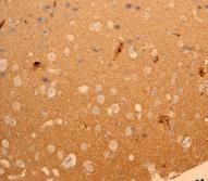 Anti-CEND1 antibody [EPR3738] used in IHC (Formalin-fixed paraffin-embedded sections). GTX62334