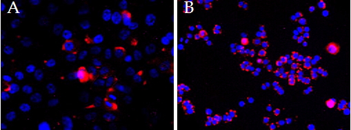 Anti-CEP290 antibody, Internal used in ICC/IF. GTX88258
