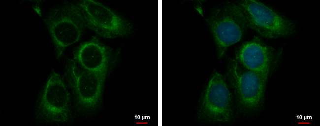 Anti-CEP70 antibody used in ICC/IF. GTX120594