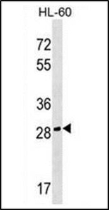 Anti-CGREF1 antibody used in Western blot. GTX53504