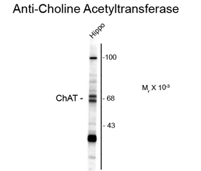 Anti-ChAT antibody used in Western blot. GTX82724