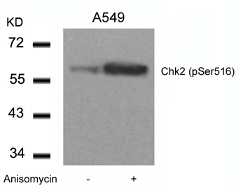 Anti-Chk2 (phospho Ser516) antibody used in Western blot. GTX50205