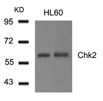 Anti-Chk2 antibody used in Western blot. GTX50698