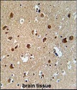 Anti-Aftiphilin antibody used in Immunohistochemistry. GTX53529