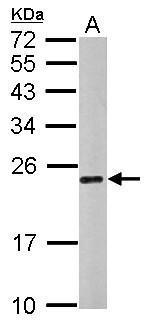 Anti-CHMP4C antibody used in Western blot. GTX122876