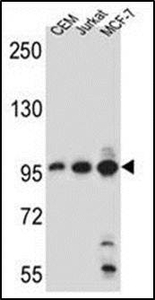 Anti-Aftiphilin antibody used in Western blot. GTX53529