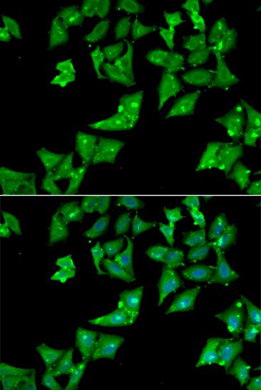 Anti-AGA antibody used in ICC/IF. GTX30031