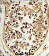 Anti-CHPF antibody, Internal used in IHC (Formalin-fixed paraffin-embedded sections). GTX80597