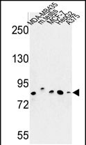 Anti-CHPF antibody, Internal used in Western blot. GTX80597