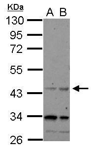 Anti-CHRFAM7A antibody [N1N3] used in Western blot. GTX121209