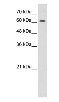 Anti-CHRNE antibody used in Western blot. GTX77688
