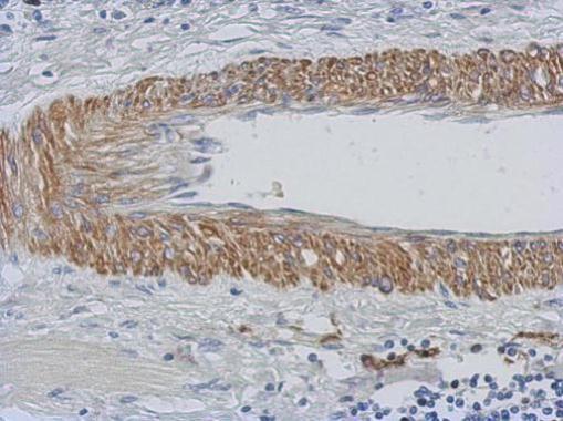 Anti-CHST15 antibody [N3C2], Internal used in IHC (Formalin-fixed paraffin-embedded sections). GTX120568
