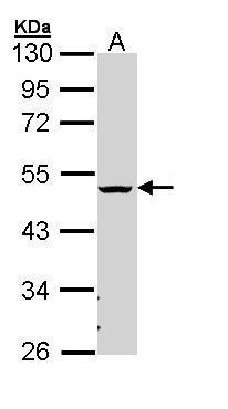 Anti-CHST5/6  antibody [N1C3] used in Western blot. GTX110290