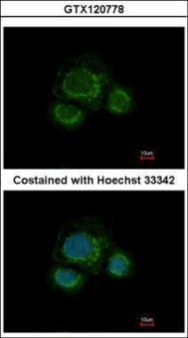 Anti-CHST7 antibody [N2C1], Internal used in ICC/IF. GTX120778