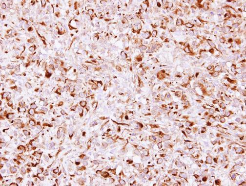 Anti-CHSY1 antibody [N2C1], Internal used in IHC (Formalin-fixed paraffin-embedded sections). GTX115638